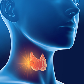 Hypothyroidism Treatment San Antonio TX